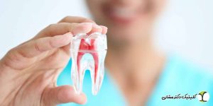 درمان عفونت دندان عصب کشی شده