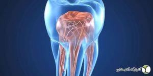 تفاوت درمان ریشه معمولی و میکروسکوپی