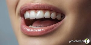 فرق کامپوزیت و لمینت چیست