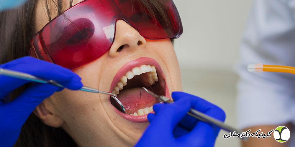 تشخیص درمان مجدد ریشه