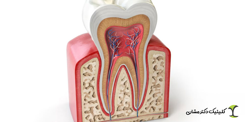 آیا تمام دندان‌ ها قابلیت درمان ریشه دارند