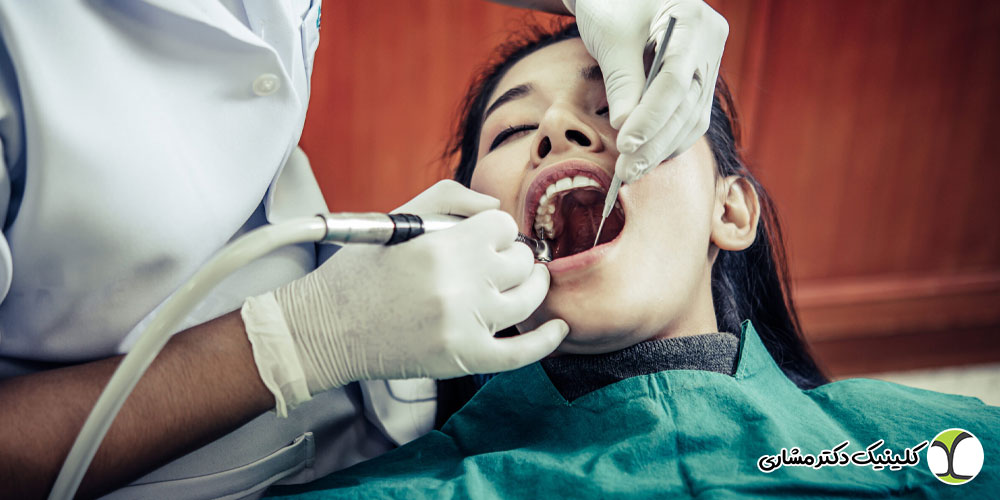 خطرات درمان ناقص ریشه دندان
