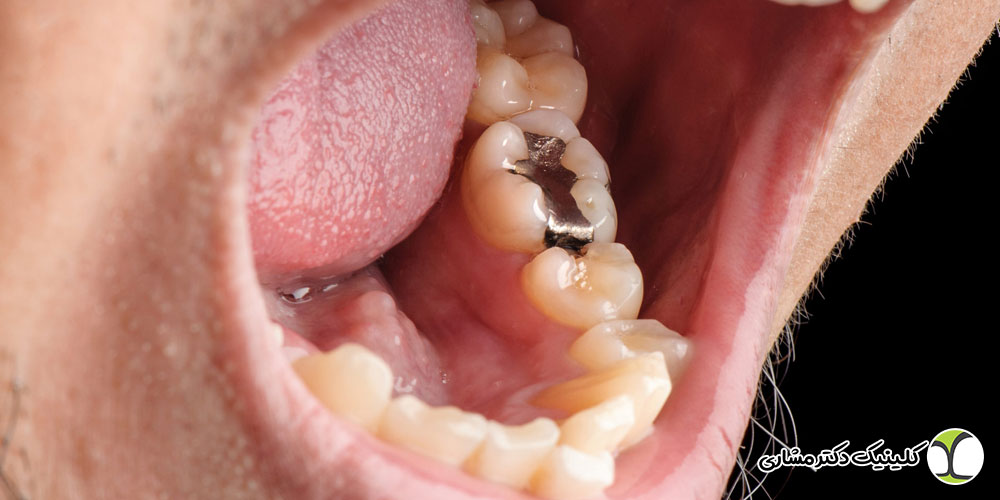 درمان مشکلات شایع دهان و دندان