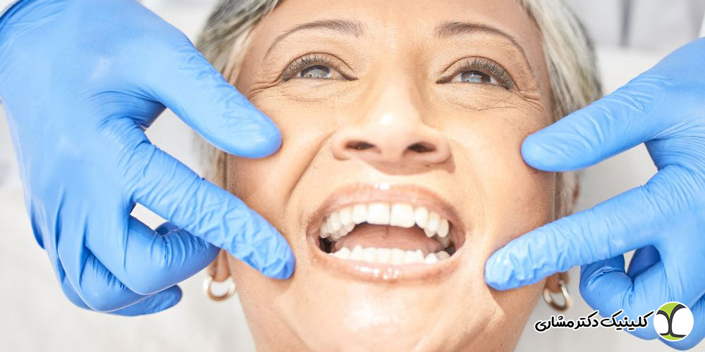 درمان مشکلات شایع دهان و دندان