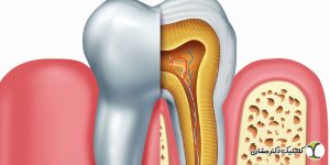 دهانه کانال ریشه در درمان‌های اندودنتیک