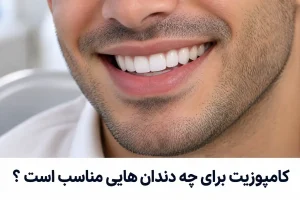 کامپوزیت برای چه دندانهایی مناسب است - تصویری از لبخند مردی جوان که کامپوزیت انجام داده است.